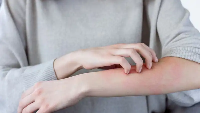 Cilt Kanserinin Gizli Belirtisi: Dermatologdan Kritik Uyarılar!