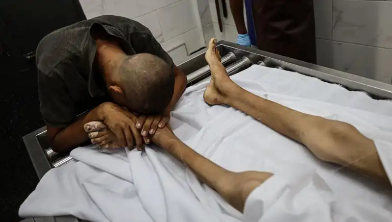 Gazze’de Açlık Krizi: Bir Çocuğun Trajedisi, Dünya Üzerinde Etkisini Sürdürüyor