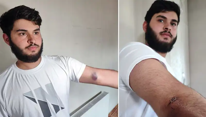 Bahçeye Kaçan Topu Aramak İçin Mahallede Kamyonetle Geziye Çıktılar
